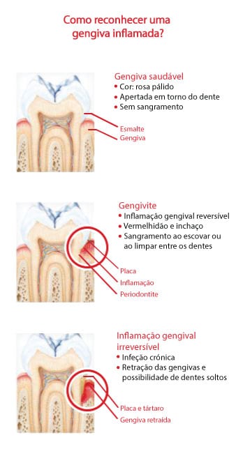 Saúde periodontal